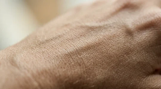 Close-up of youthful skin demonstrating natural collagen fiber network and cellular regeneration